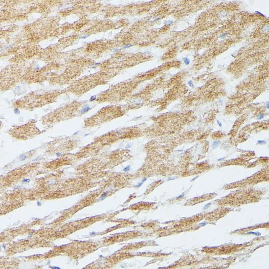 IHC-P analysis of rat heart tissue using GTX55702 MEK5 antibody. Dilution : 1:100