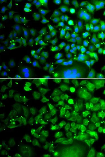 ICC/IF analysis of A549 cells using GTX55710 MOCS3 antibody. Blue : DAPI