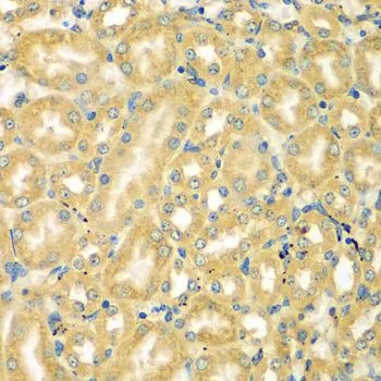 IHC-P analysis of mouse kidney tissue using GTX55710 MOCS3 antibody. Dilution : 1:100