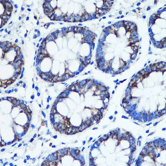 IHC-P analysis of human colon tissue using GTX55711 Monoamine Oxidase B antibody. Dilution : 1:100