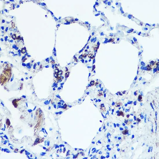 IHC-P analysis of rat lung tissue using GTX55711 Monoamine Oxidase B antibody. Dilution : 1:100