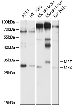 WB analysis of various sample lysates using GTX55712 MPZ antibody. The signal was developed with ECL plus-Enhanced. Dilution : 1:1000 Loading : 25microg per lane WB analysis of various sample lysates using GTX55712 MPZ antibody. The signal was developed with ECL plus-Enhanced. Dilution : 1:1000 Loading : 25microg per lane