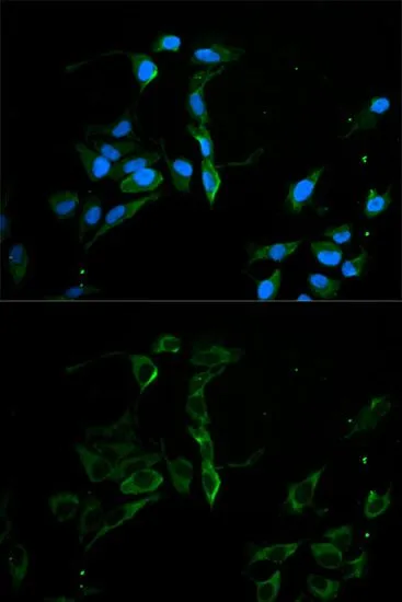 ICC/IF analysis of U2OS cells using GTX55715 MVP/LRP antibody. Blue : DAPI Dilution : 1:100 ICC/IF analysis of U2OS cells using GTX55715 MVP/LRP antibody. Blue : DAPI Dilution : 1:100