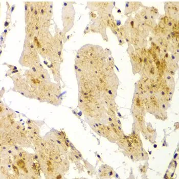 IHC-P analysis of human esophagus tissue using GTX55715 MVP/LRP antibody. Dilution : 1:100 IHC-P analysis of human esophagus tissue using GTX55715 MVP/LRP antibody. Dilution : 1:100