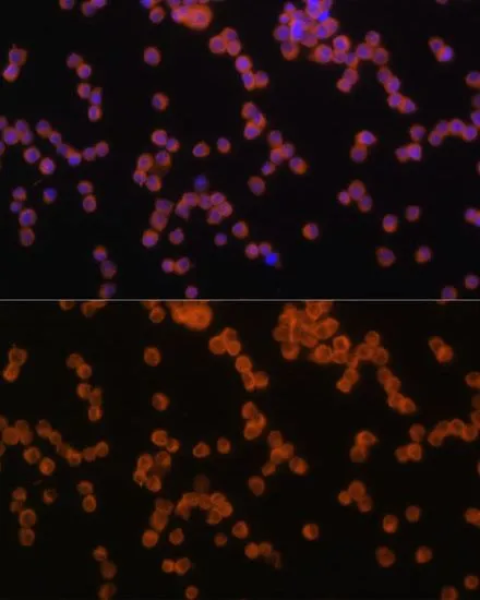ICC/IF analysis of Raw264.7 cells using GTX55716 MyD88 antibody. Blue : DAPI Dilution : 1:100