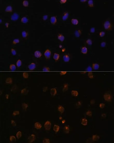 ICC/IF analysis of Jurkat cells using GTX55716 MyD88 antibody. Blue : DAPI Dilution : 1:100