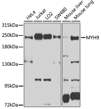 WB analysis of various sample lysates using GTX55718 MYH9 antibody. Dilution : 1:1000 Loading : 25microg per lane