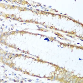 IHC-P analysis of human stomach tissue using GTX55718 MYH9 antibody. Dilution : 1:100