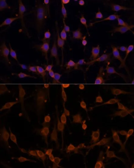 ICC/IF analysis of C6 cells using GTX55727 nm23-H1 antibody. Blue : DAPI Dilution : 1:100
