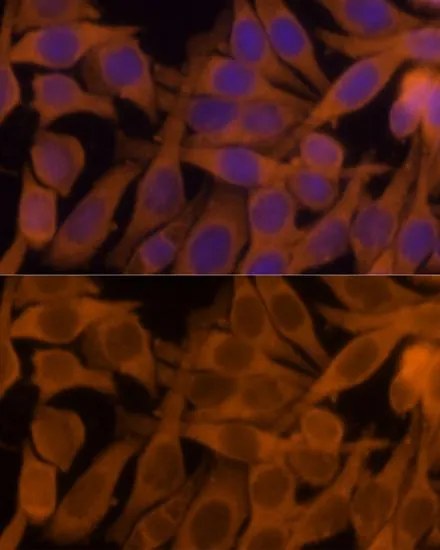 ICC/IF analysis of HeLa cells using GTX55727 nm23-H1 antibody. Blue : DAPI Dilution : 1:100