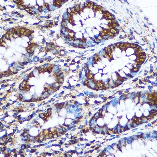 IHC-P analysis of human colon tissue using GTX55727 nm23-H1 antibody. Dilution : 1:100
