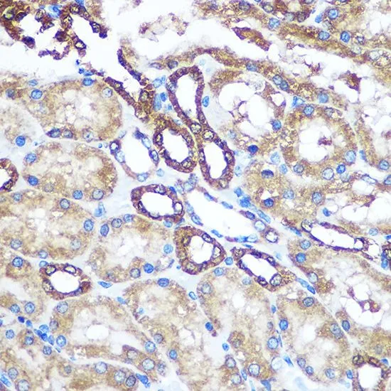 IHC-P analysis of rat kidney tissue using GTX55727 nm23-H1 antibody. Dilution : 1:100