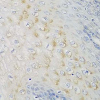 IHC-P analysis of human esophagus tissue using GTX55728 NME4 antibody. Dilution : 1:100