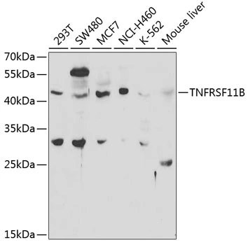 WB analysis of various sample lysates using GTX55734 OPG antibody. Dilution : 1:1000 Loading : 25microg per lane WB analysis of various sample lysates using GTX55734 OPG antibody. Dilution : 1:1000 Loading : 25microg per lane