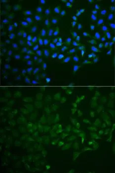 ICC/IF analysis of HeLa cells using GTX55734 OPG antibody. Blue : DAPI
