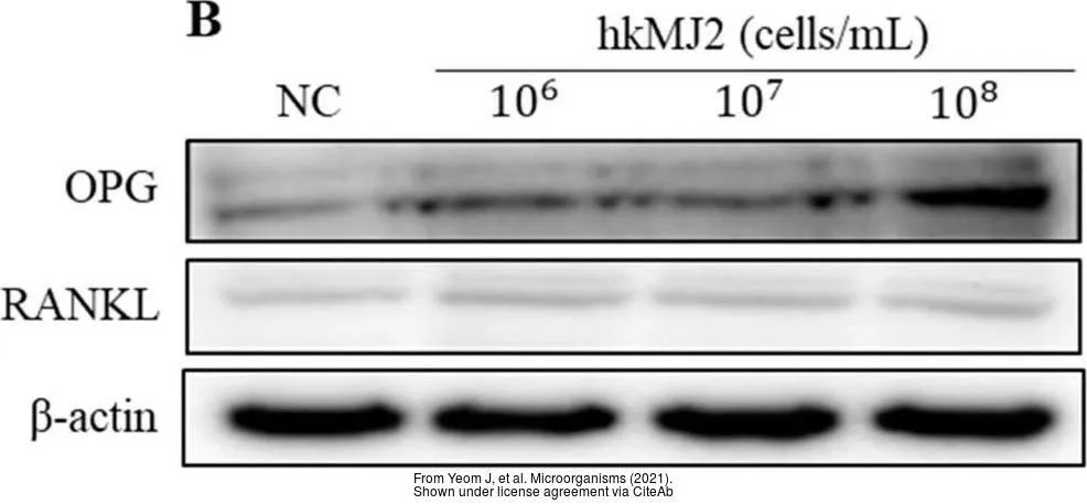 The data was published in the 2021 in Microorganisms. PMID: 33805153