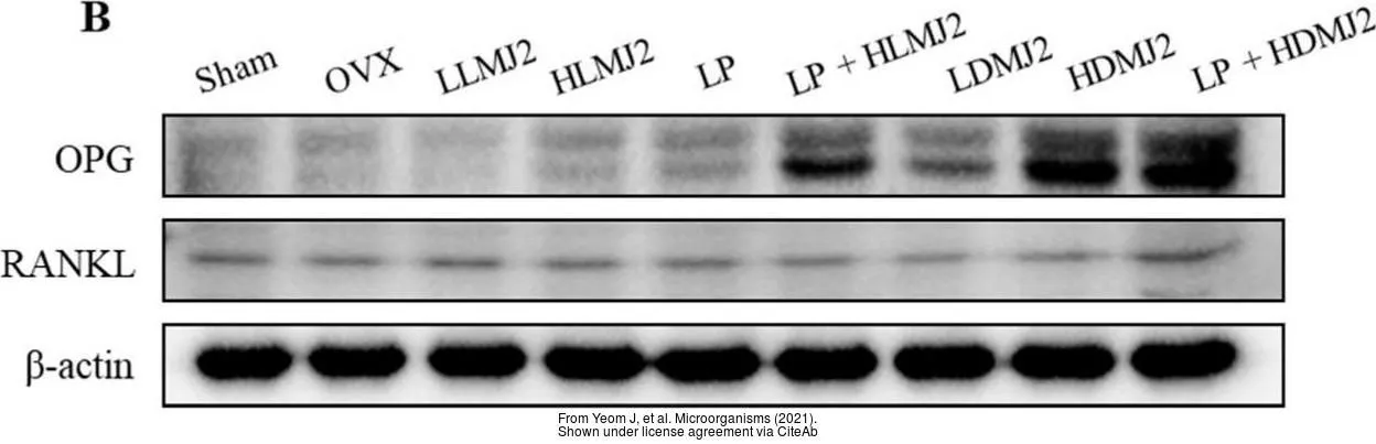 The data was published in the 2021 in Microorganisms. PMID: 33805153