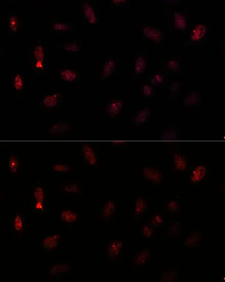 ICC/IF analysis of U2OS cells using GTX55739 PAX6 antibody. Blue : DAPI Dilution : 1:100