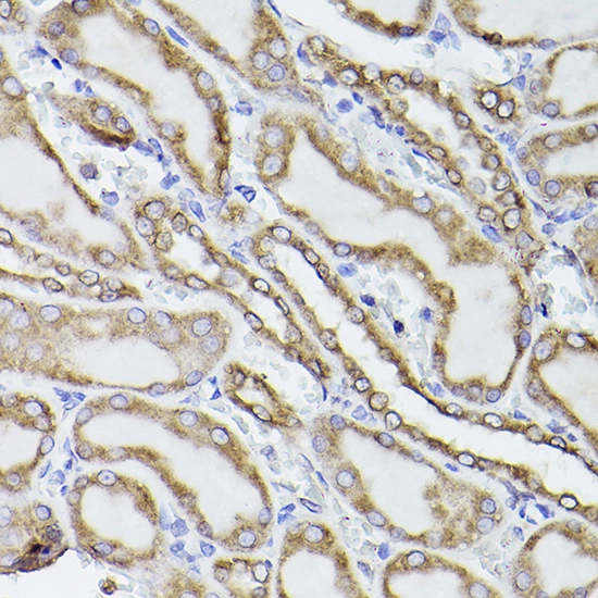 IP analysis of SW620 cell lysate using GTX55742 PDI antibody. Antibody amount : 3microg / 200microg lysate Dilution : 1:500 IP analysis of SW620 cell lysate using GTX55742 PDI antibody. Antibody amount : 3microg / 200microg lysate Dilution : 1:500
