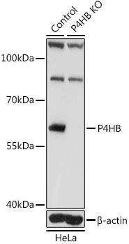 WB analysis of normal (control) and knockout (KO) HeLa cell lysate using GTX55742 PDI antibody. Dilution : 1:1000 Loading : 25microg per lane
