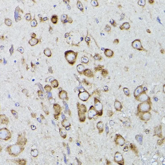 ICC/IF analysis of U2OS cells using GTX55742 PDI antibody. Blue : DAPI Dilution : 1:400