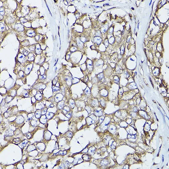 ICC/IF analysis of HeLa cells using GTX55742 PDI antibody. Blue : DAPI