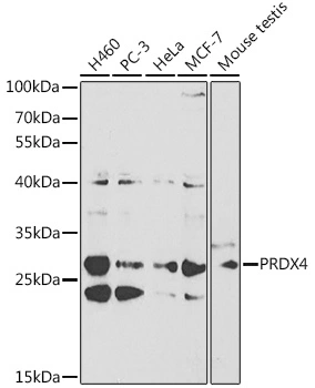 WB analysis of various sample lysates using GTX55743 PRX IV antibody. Dilution : 1:1000 Loading : 25microg per lane