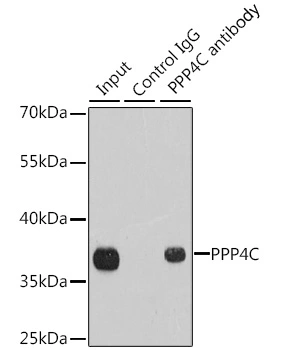 IP analysis of 293T cell lysate using GTX55756 PPP4C antibody. Antibody amount : 1microg / 200microg lysate Dilution : 1:1000 IP analysis of 293T cell lysate using GTX55756 PPP4C antibody. Antibody amount : 1microg / 200microg lysate Dilution : 1:1000