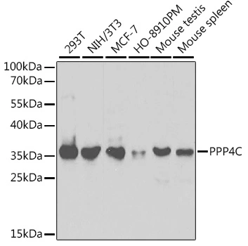 WB analysis of various sample lysates using GTX55756 PPP4C antibody. Dilution : 1:1000 Loading : 25microg per lane