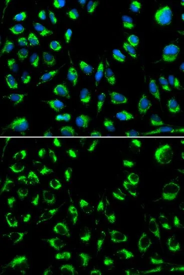 ICC/IF analysis of MCF7 cells using GTX55756 PPP4C antibody. Blue : DAPI