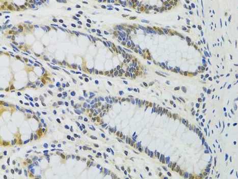 IHC-P analysis of human colon tissue using GTX55756 PPP4C antibody. Dilution : 1:100