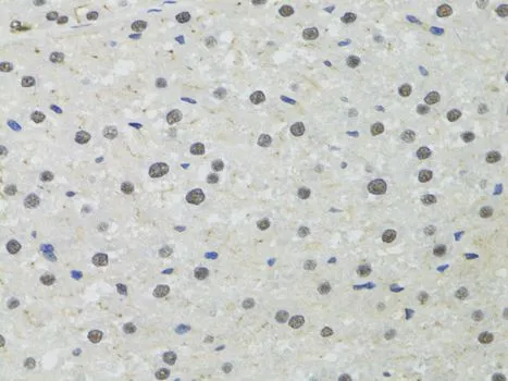 IHC-P analysis of rat liver tissue using GTX55756 PPP4C antibody. Dilution : 1:100