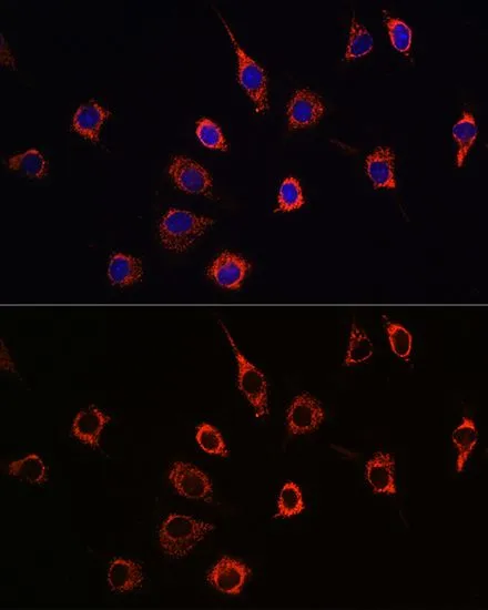 ICC/IF analysis of L929 cells using GTX55757 Presenilin 1 antibody. Blue : DAPI Dilution : 1:100