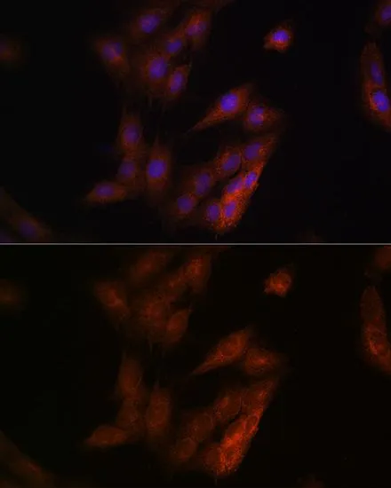 ICC/IF analysis of C6 cells using GTX55757 Presenilin 1 antibody. Blue : DAPI Dilution : 1:100
