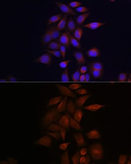 ICC/IF analysis of HeLa cells using GTX55757 Presenilin 1 antibody. Blue : DAPI Dilution : 1:100
