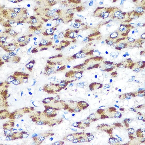 IHC-P analysis of human liver tissue using GTX55757 Presenilin 1 antibody. Dilution : 1:100