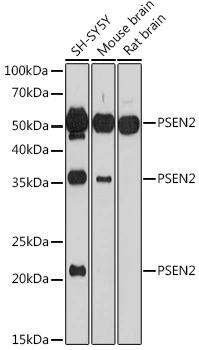 WB analysis of various sample lysates using GTX55758 Presenilin 2 antibody. Dilution : 1:1000 Loading : 25microg per lane WB analysis of various sample lysates using GTX55758 Presenilin 2 antibody. Dilution : 1:1000 Loading : 25microg per lane