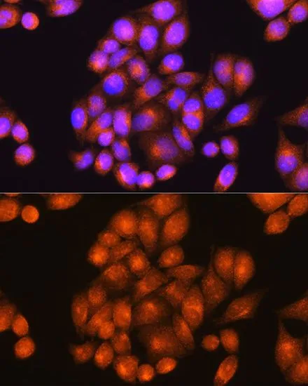 ICC/IF analysis of HeLa cells using GTX55758 Presenilin 2 antibody. Blue : DAPI Dilution : 1:100
