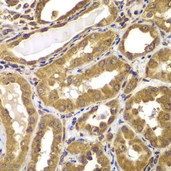 IHC-P analysis of human kidney tissue using GTX55758 Presenilin 2 antibody. Dilution : 1:100