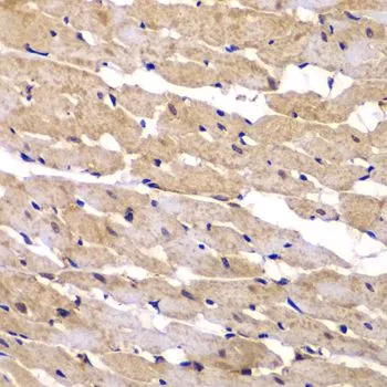IHC-P analysis of rat heart tissue using GTX55758 Presenilin 2 antibody. Dilution : 1:100