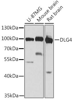 WB analysis of various sample lysates using GTX55760 PSD95 antibody. Dilution : 1:1000 Loading : 25microg per lane WB analysis of various sample lysates using GTX55760 PSD95 antibody. Dilution : 1:1000 Loading : 25microg per lane