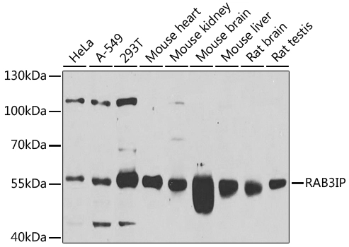 WB analysis of various sample lysates using GTX55771 RAB3IP antibody. Dilution : 1:1000 Loading : 25microg per lane WB analysis of various sample lysates using GTX55771 RAB3IP antibody. Dilution : 1:1000 Loading : 25microg per lane