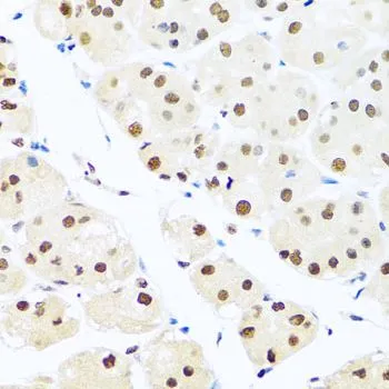 IHC-P analysis of human stomach tissue using GTX55771 RAB3IP antibody. Dilution : 1:100