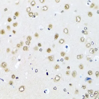 IHC-P analysis of rat brain tissue using GTX55771 RAB3IP antibody. Dilution : 1:100
