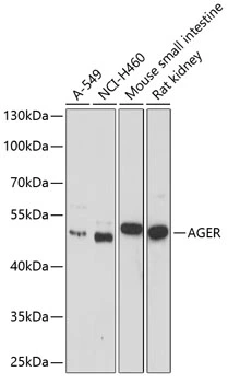 WB analysis of various sample lysates using GTX55773 RAGE antibody. Dilution : 1:1000 Loading : 25microg per lane WB analysis of various sample lysates using GTX55773 RAGE antibody. Dilution : 1:1000 Loading : 25microg per lane