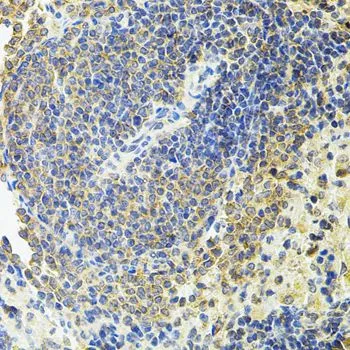 IHC-P analysis of rat spleen tissue using GTX55774 RalBP1 antibody. Dilution : 1:100
