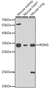 WB analysis of various sample lysates using GTX55776 RDM1 antibody. Dilution : 1:1000 Loading : 25microg per lane WB analysis of various sample lysates using GTX55776 RDM1 antibody. Dilution : 1:1000 Loading : 25microg per lane