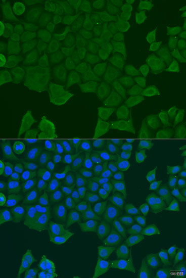 WB analysis of various samples using GTX55777 REEP1 antibody. Dilution : 1:1000 Loading : 25ug per lane