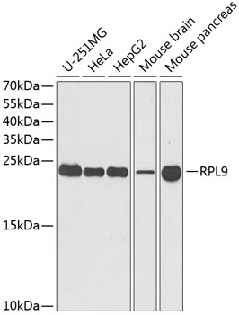WB analysis of various sample lysates using GTX55785 RPL9 antibody. Dilution : 1:1000 Loading : 25microg per lane WB analysis of various sample lysates using GTX55785 RPL9 antibody. Dilution : 1:1000 Loading : 25microg per lane