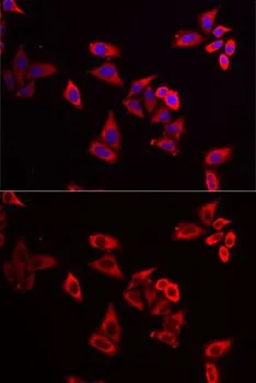 ICC/IF analysis of MCF7 cells using GTX55785 RPL9 antibody. Blue : DAPI